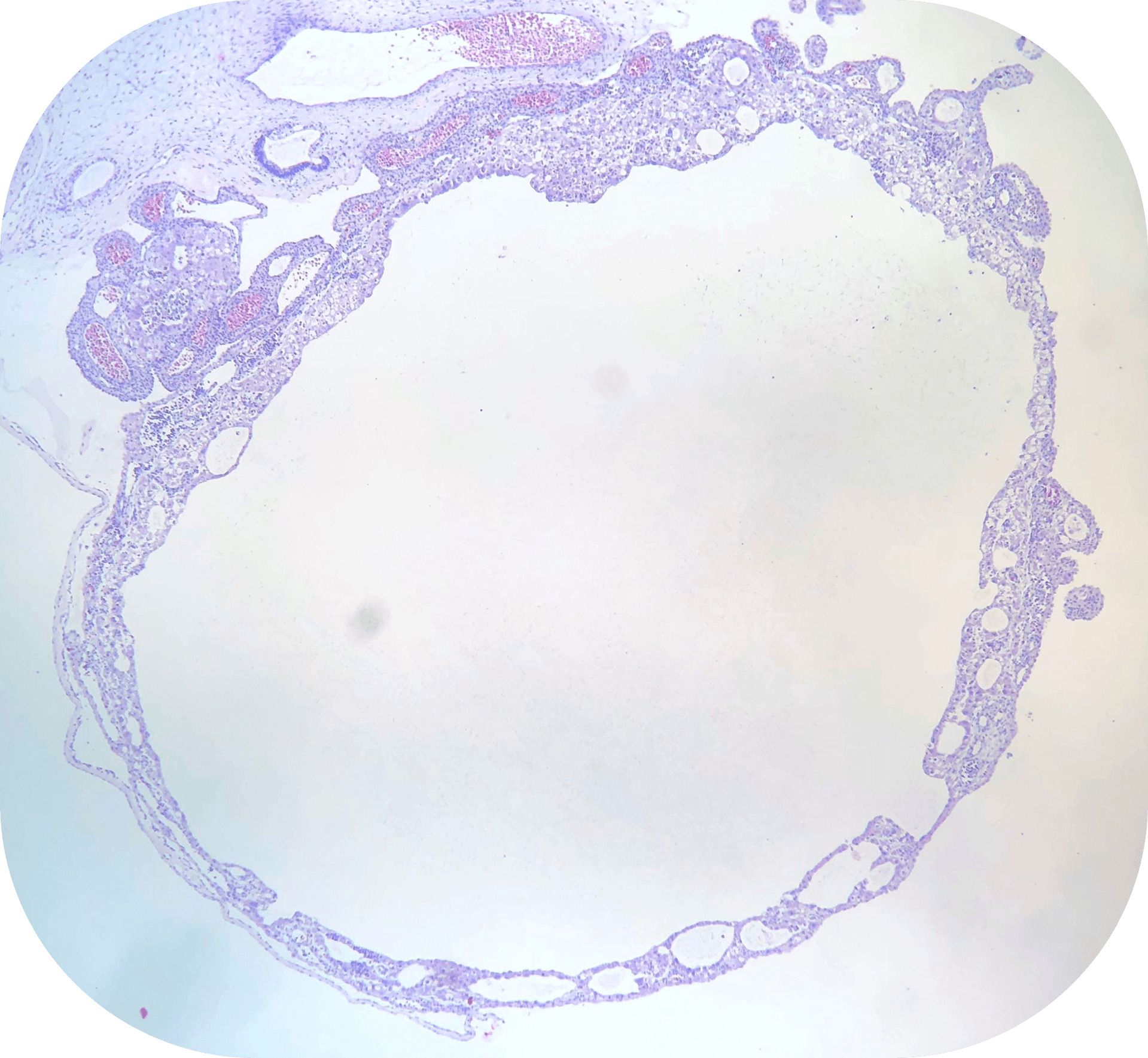 A digitally rendered image of a white blood cell.